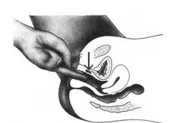 女人阴户毛茸茸修剪护理心得分享及常见误区解读 女人阴户毛茸茸修剪护理心得分享及常见误区解读